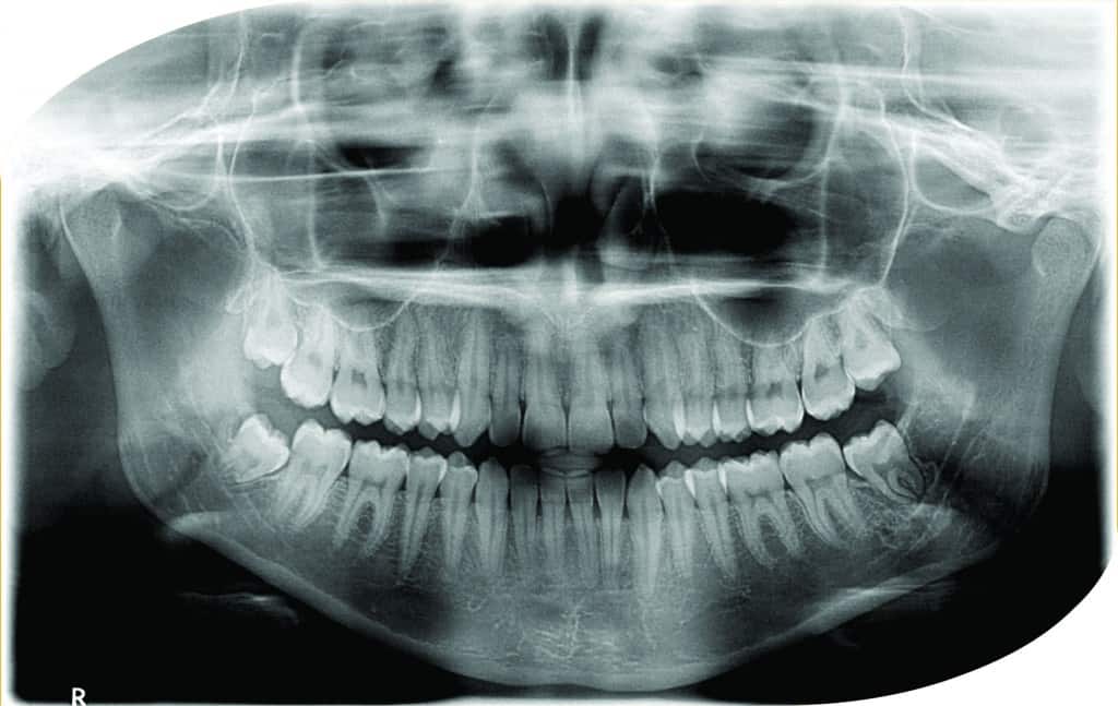 Radiografias Extra-Orais